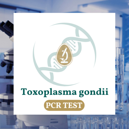 Toxoplasma gondii test